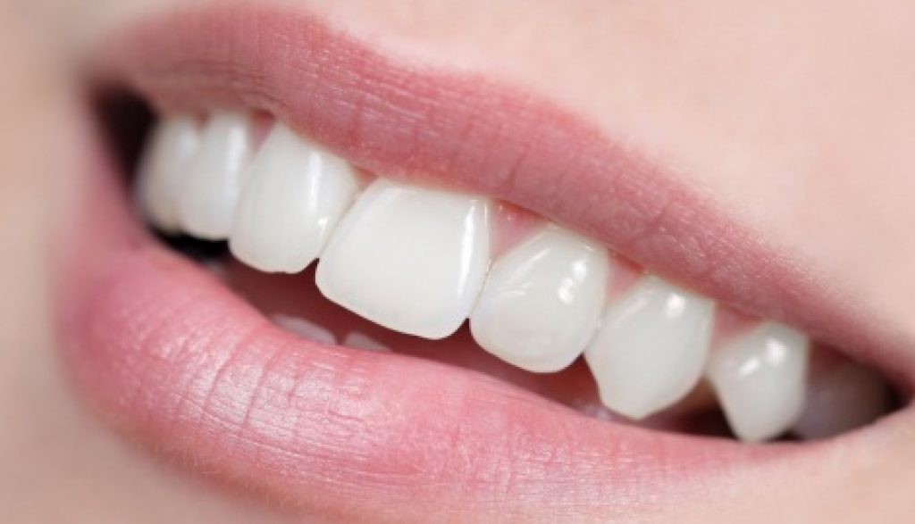 Comment avoir les dents blanches_0