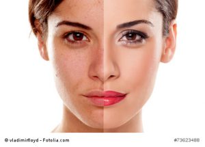 Comparison portrait of a woman without and with makeup